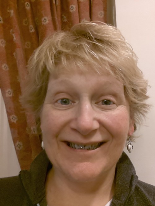 No one told me that having braces makes your eyes puffy. 